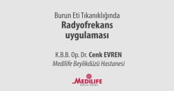 Konka Radyofrekansı